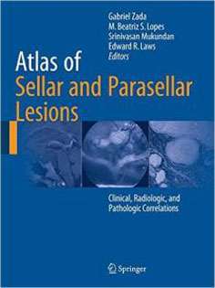 Atlas of Sellar and Parasellar Lesions