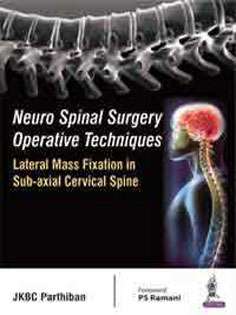 Lateral Mass Fixation in Sub-axial Cervical Spine