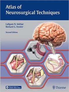 Atlas of Neurosurgical Techniques: Brain