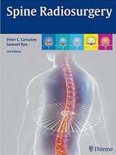 Spine Radiosurgery