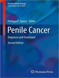 Penile Cancer: Diagnosis and Treatment