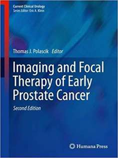 Imaging and Focal Therapy of Early Prostate Cancer