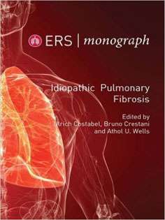 Idiopathic Pulmonary Fibrosis