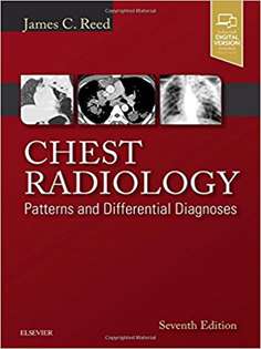 Chest Radiology: Patterns and Differential Diagnoses