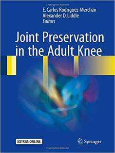 Joint Preservation in the Adult Knee