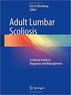 Adult Lumbar Scoliosis: A Clinical Guide to Diagnosis and Management