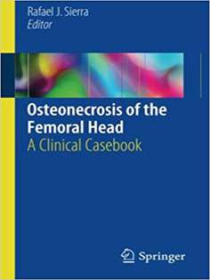 Osteonecrosis of the Femoral Head
