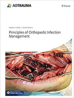 Principles of Orthopedic Infection Management