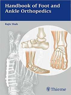 Handbook of Foot and Ankle Orthopedics