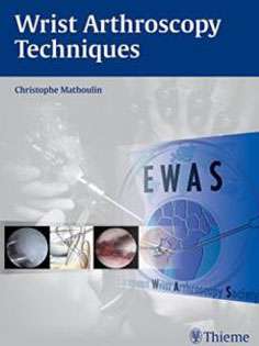 Wrist Arthroscopy Techniques