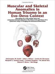 Muscular and Skeletal Anomalies in Human Trisomy in an Evo-Devo Context