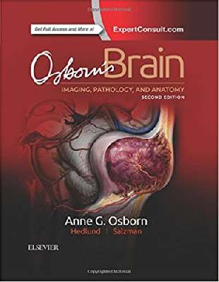 Osborn`s Brain