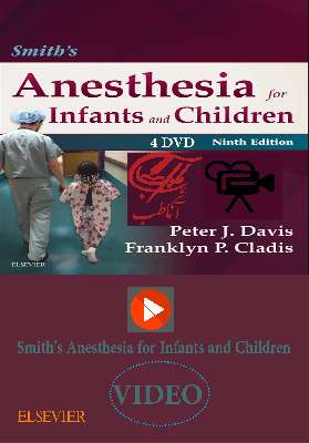 Smith's Anesthesia for Infants and Children