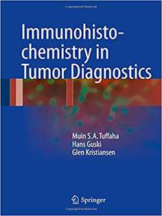 Immunohistochemistry in Tumor Diagnostics