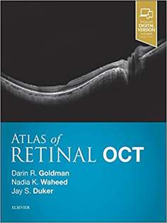 Atlas of Retinal OCT: Optical Coherence Tomography