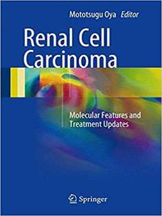 Renal Cell Carcinoma: Molecular Features and Treatment Updates