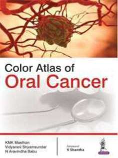 Color Atlas of Oral Cancer