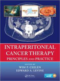 Intraperitoneal Cancer Therapy: Principles and Practice