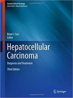 Hepatocellular Carcinoma: Diagnosis and Treatment