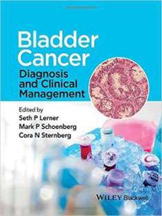 Bladder Cancer: Diagnosis and Clinical Management