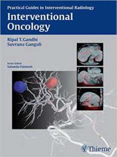 Interventional Oncology