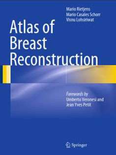 Atlas of Breast Reconstruction