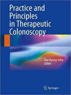 Practice and Principles in Therapeutic Colonoscopy