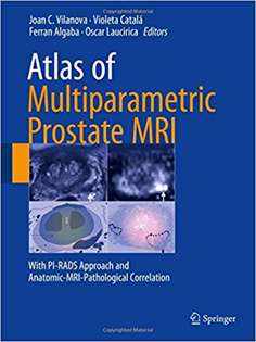 Atlas of Multiparametric Prostate MRI