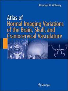 Atlas of Normal Imaging Variations of the Brain, Skull, and Craniocervical Vasculature