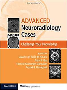 Advanced Neuroradiology Cases: Challenge Your Knowledge