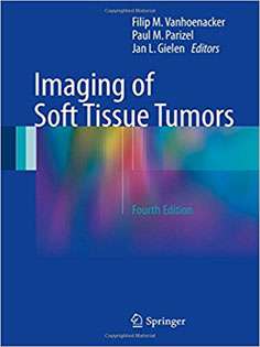 Imaging of Soft Tissue Tumors