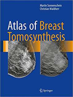 Atlas of Breast Tomosynthesis