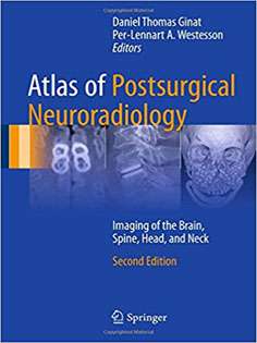 Atlas of Postsurgical Neuroradiology