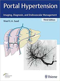 Portal Hypertension