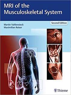 MRI of the Musculoskeletal System