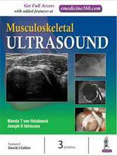 Musculoskeletal Ultrasound