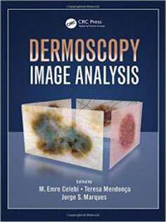 Dermoscopy Image Analysis