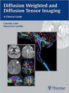 Diffusion Weighted and Diffusion Tensor Imaging: A Clinical Guide