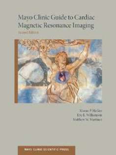 Mayo Clinic Guide to Cardiac Magnetic Resonance Imaging