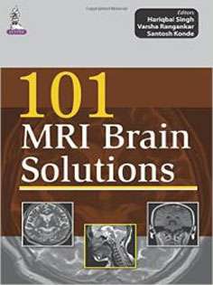 101 MRI Brain Solutions