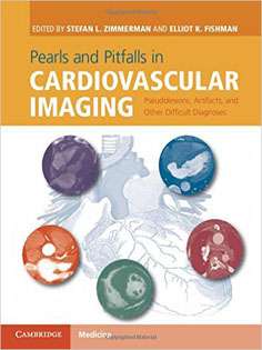 Pearls and Pitfalls in Cardiovascular Imaging: Pseudolesions, Artifacts, and Other Difficult Diagnoses