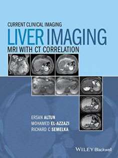Liver Imaging: MRI with CT Correlation