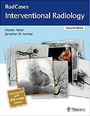 Radcases Interventional Radiology