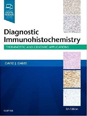 Diagnostic Immunohistochemistry: Theranostic and Genomic Applications Dabbs