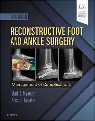 Reconstructive Foot and Ankle Surgery : Management of Complications   2019