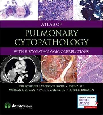 Atlas of Pulmonary Cytopathology