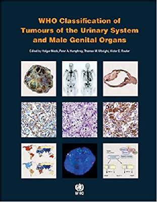 WHO Classification of Tumours of the Central Nervous System