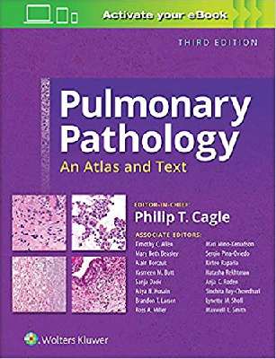 Pulmonary Pathology: An Atlas and Text