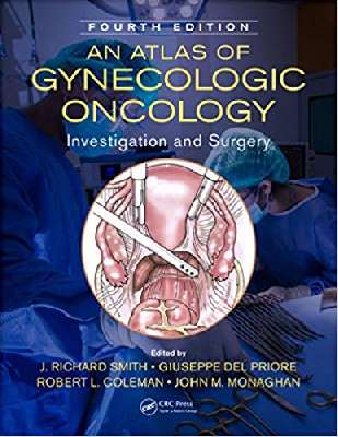 An Atlas of Gynecologic Oncology: Investigation and Surgery