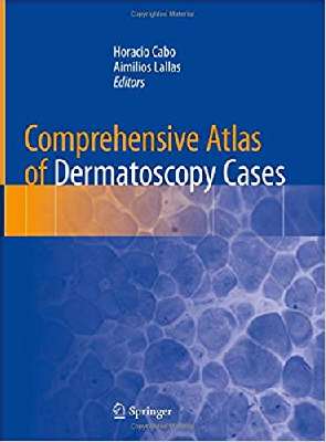 Comprehensive Atlas of Dermatoscopy Cases